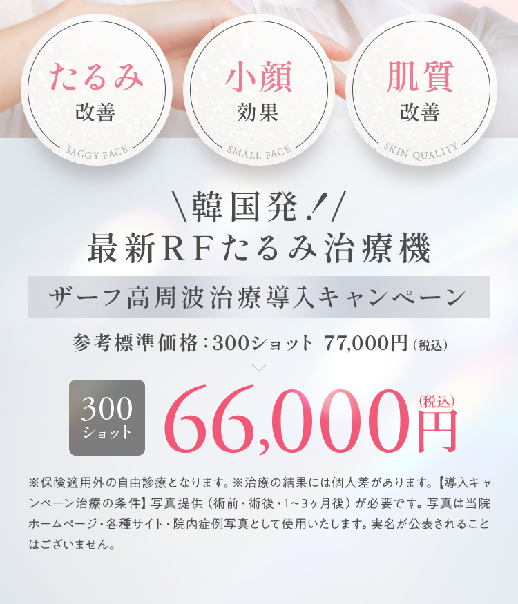 ザーフ高周波治療導入キャンペーン